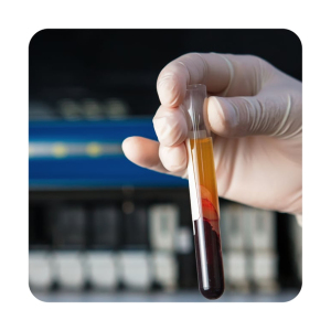 PRP (Platelet Rich Plazma)